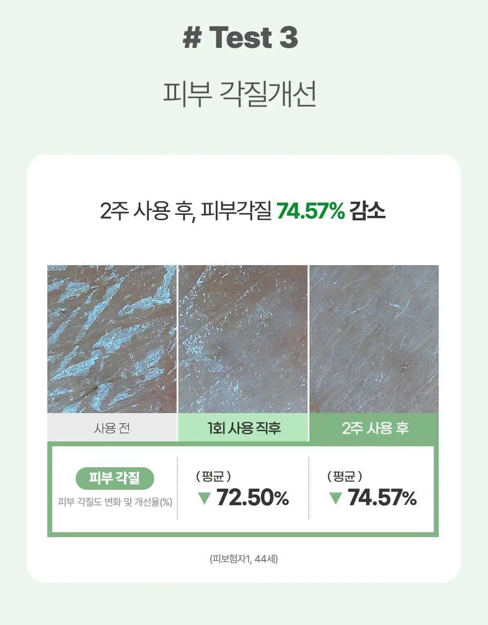 [국민크림] 김정문알로에 큐어크림 50g 상세페이지 11